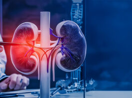 Incontinencia urinaria de esfuerzo: qué es, causas y tratamiento efectivo